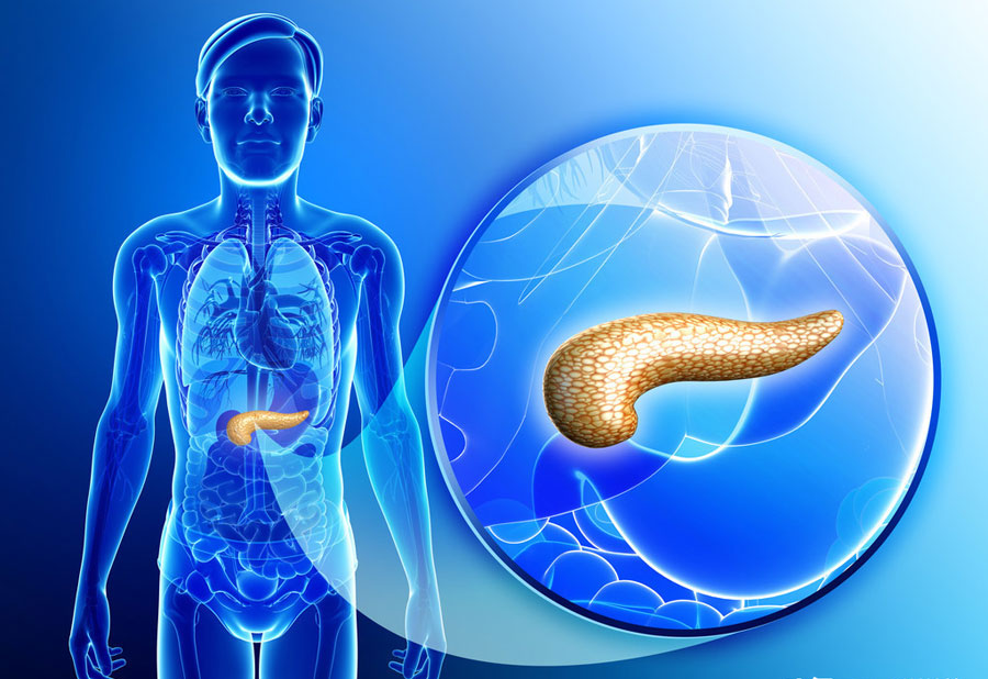 胰腺癌早期症状有哪些？身体出现这5种症状之一，别掉以轻心，要尽快检查