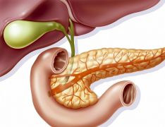 胰腺癌早期有哪些信号？治疗胰腺癌有什么好的方法？